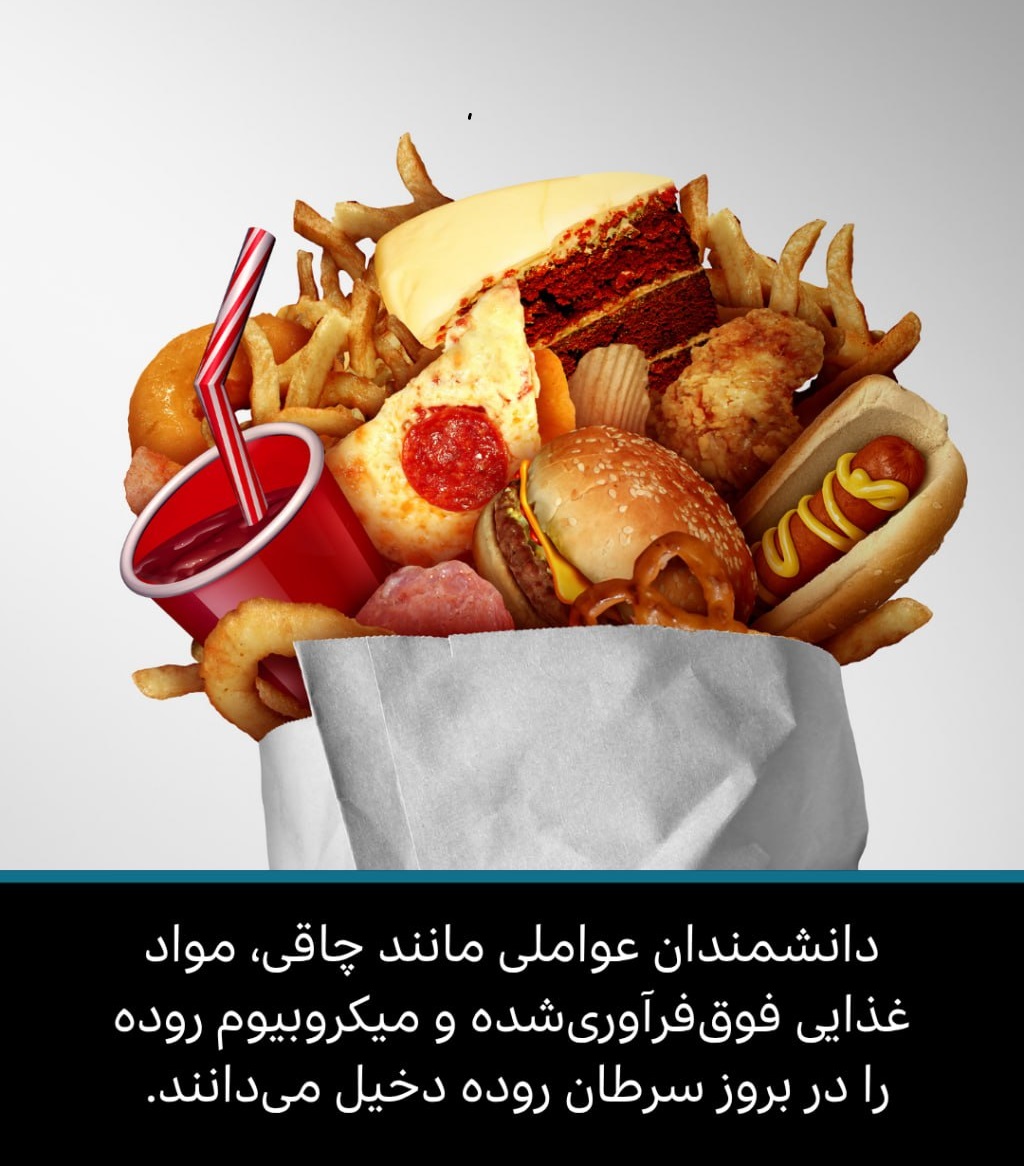 در جستوجوی سرنخهایی درباره افزایش بروز سرطان روده در میان جوانان در جستوجوی سرنخهایی درباره افزایش بروز سرطان روده در میان جوانان